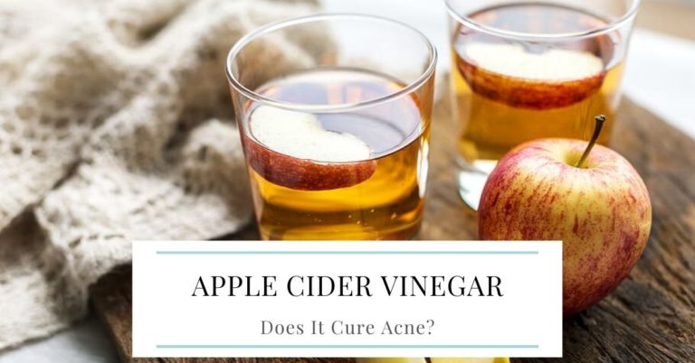 Does Apple Cider Vinegar cure acne?