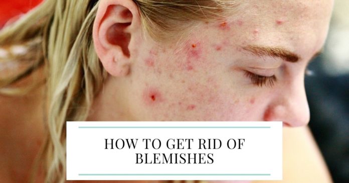 Get Rid of Blemishes
