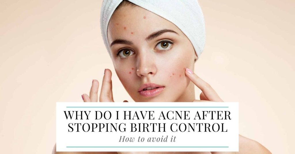 Why Do I Have Acne After Stopping Birth Control & How To Avoid It