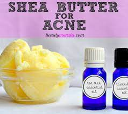 Shea butter for acne