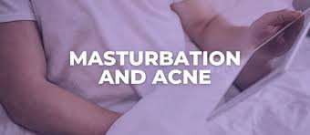 Does Masturbation Cause Acne?
